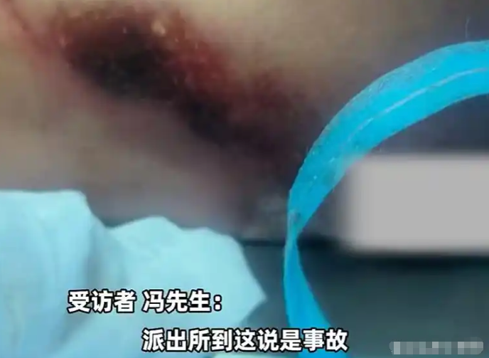 悲剧！河北女子骑车被狗撞倒身亡，主人为躲赔偿将狗打死 - php中文网