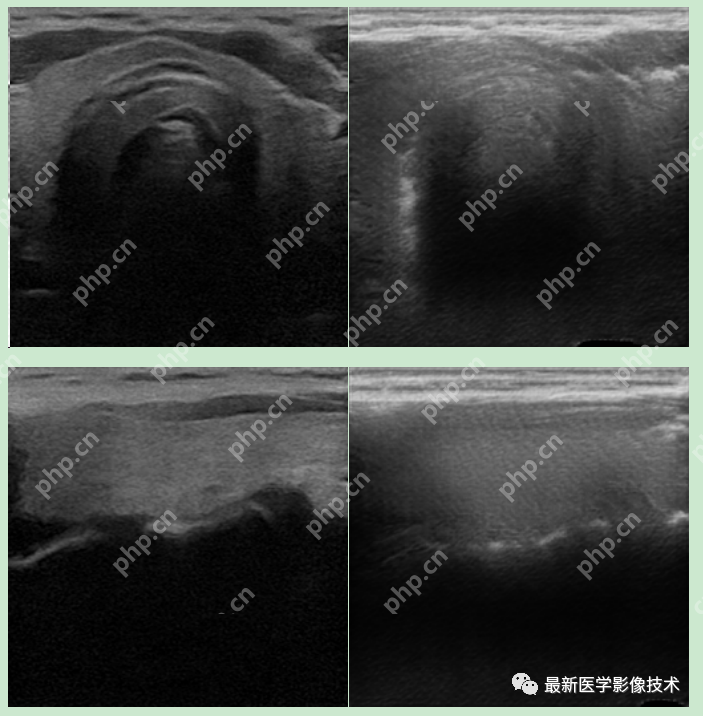 USenhance2023——2023 年超声图像增强挑战赛