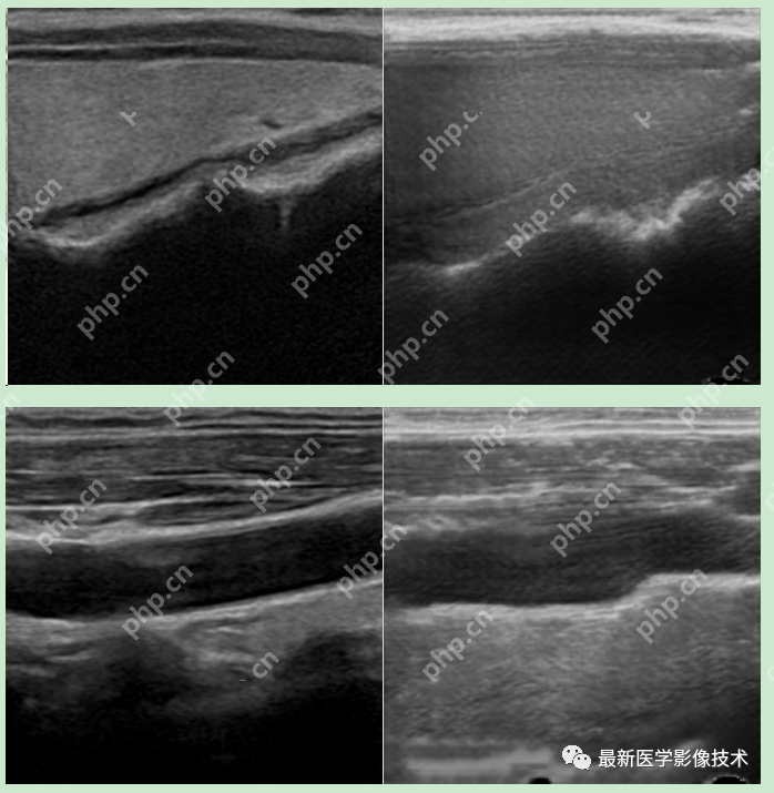 USenhance2023——2023 年超声图像增强挑战赛